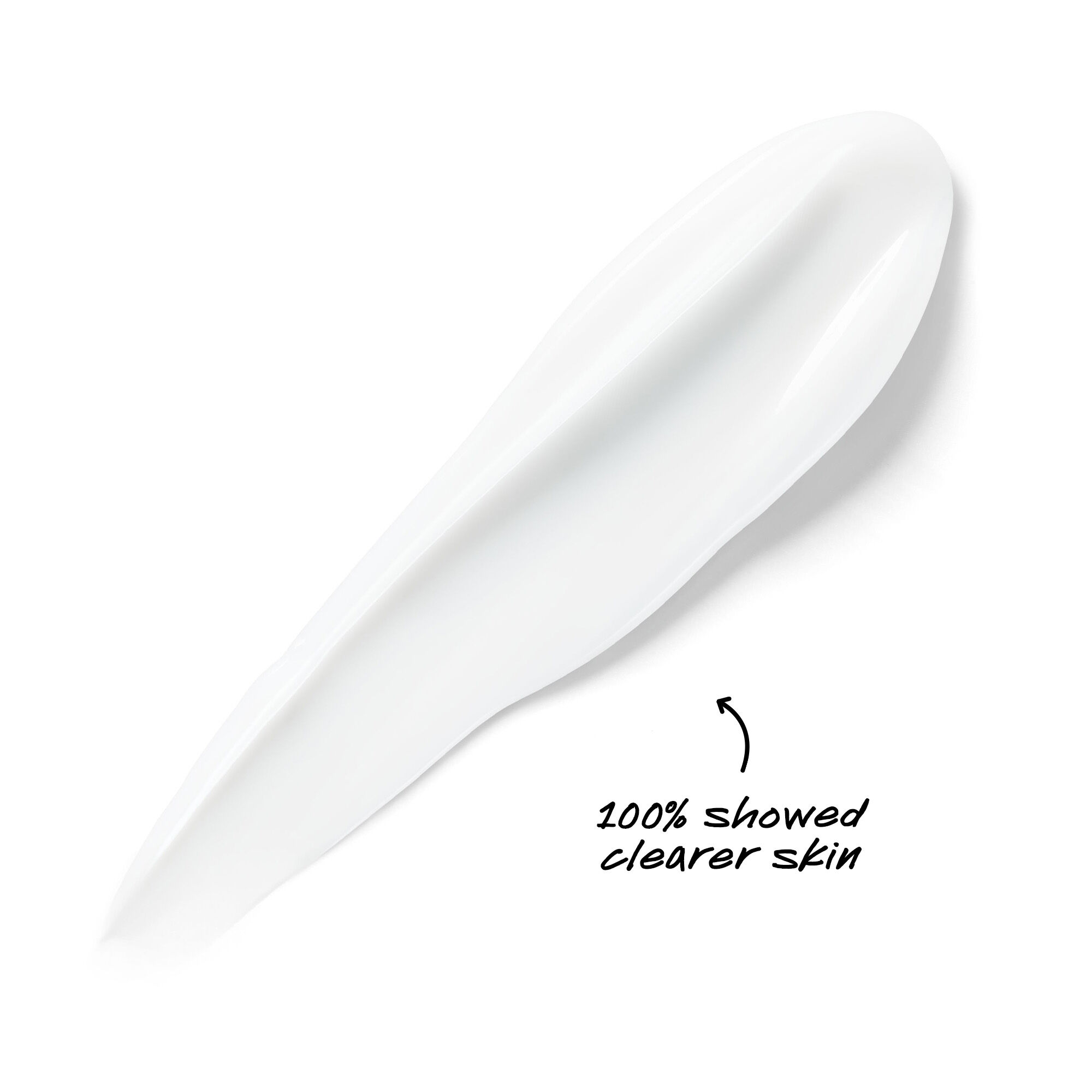 Expertly Clear Blemish-Treating & Preventing Lotion