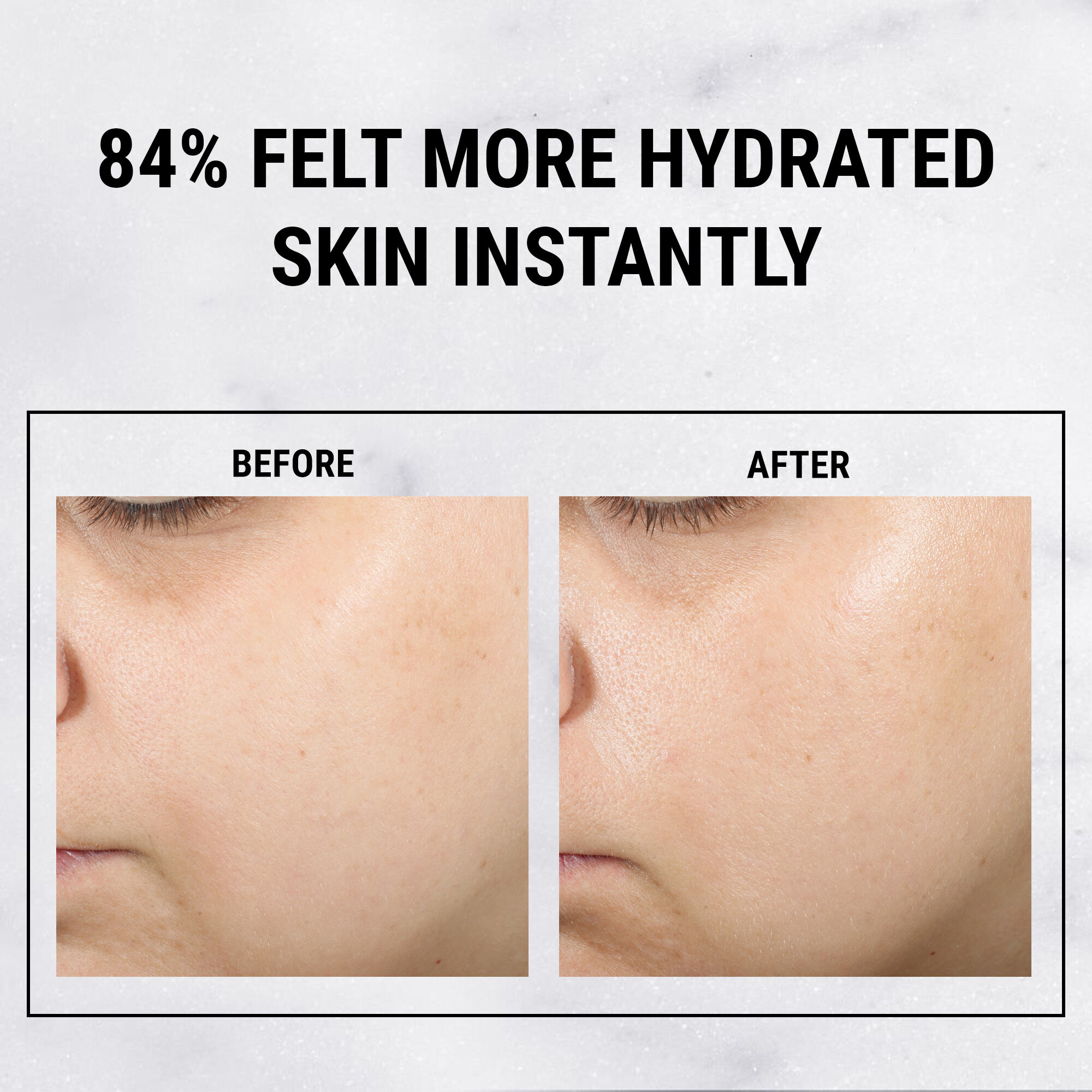 Ultra Pure High-Potency Serum 1.5% Hyaluronic Acid