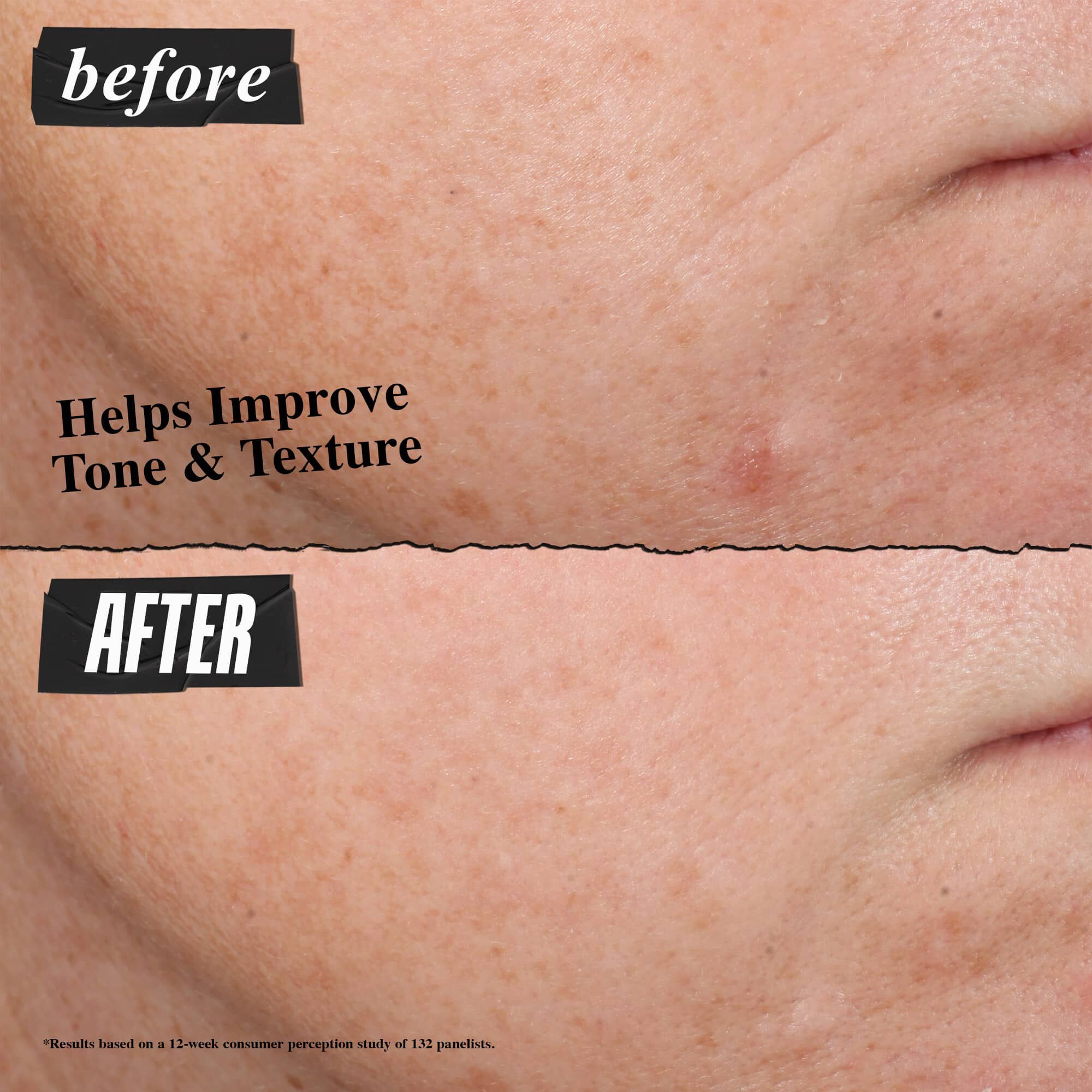 Retinol Skin-Renewing Daily Micro-Dose Serum